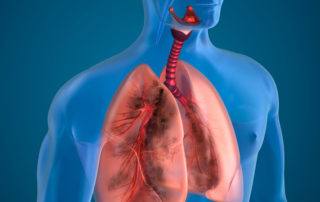 Lung Ct Scan Illustration