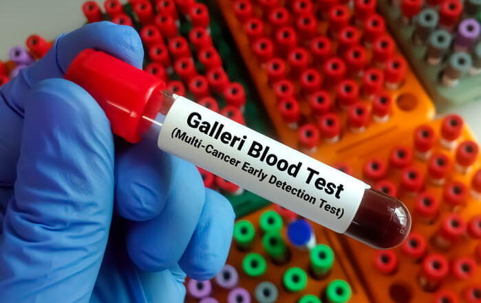 A Vial Filled With Blood Labeled: &Quot;Galleri Blood Test (Multi-Cancer Early Detection Test).